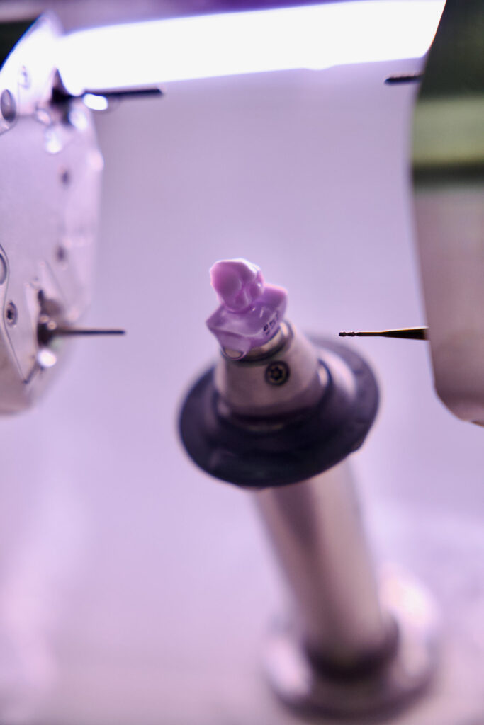 CEREC Digitale Zahnmedizin ohne Abdruck in Kempten