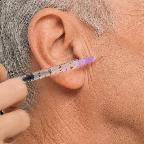 Botox-Behandlung für Kieferprobleme